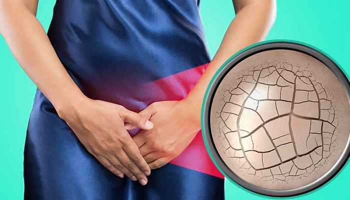 Bewährte Hausmittel gegen vaginale Trockenheit (Vaginalatrophie) und beste natürliche Gleitmittel