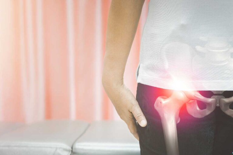 Hüftverstauchung: Ursachen, Symptome, Behandlung, Übungen